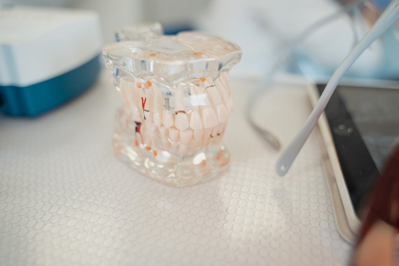 What is the Difference Between Fixed Dentures and Implant Dentures?